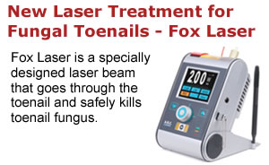 Fox Laser for Fungal Toenails